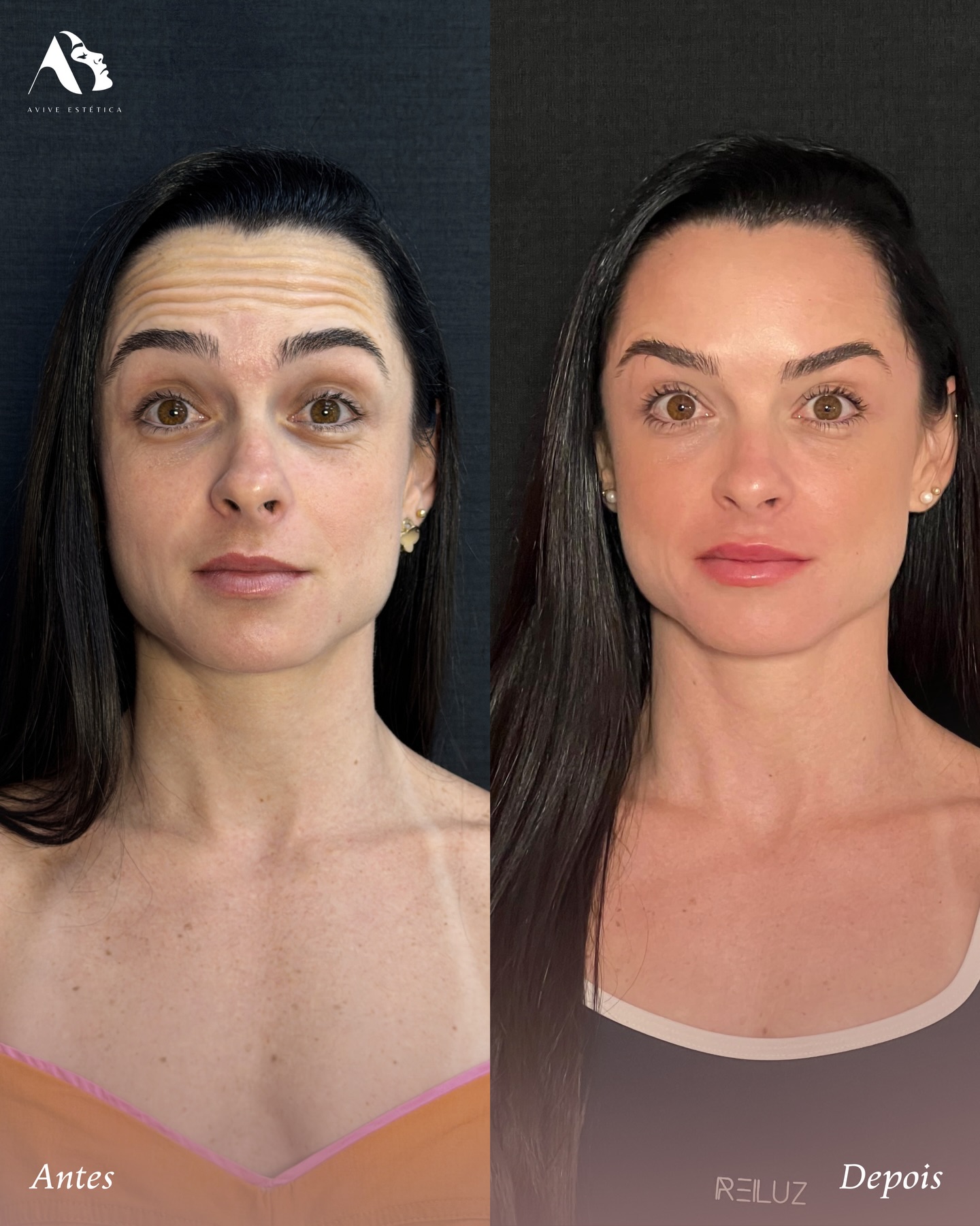 Cuidado facial · 01: depois